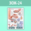 Плакат «Синдром запястного канала (кистевой туннельный синдром)» (ЗОЖ-24, ламинир. бумага, A1, 1 лист)